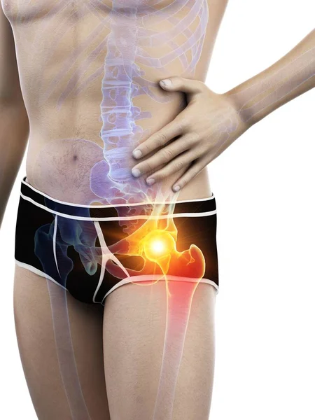Male Body Silhouette Visible Hip Pain Digital Illustration — Stock Photo, Image
