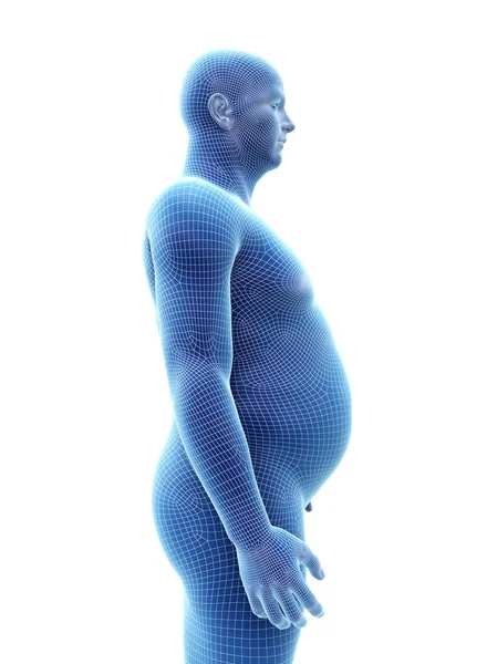 Obez Adamın Mavi Anatomik Modeli Dijital Illüstrasyon — Stok fotoğraf