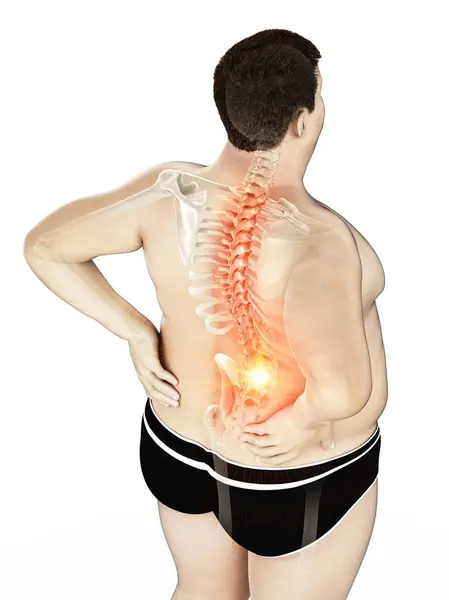 肥胖男性身体与背部疼痛在高角度视图 数字插图 — 图库照片