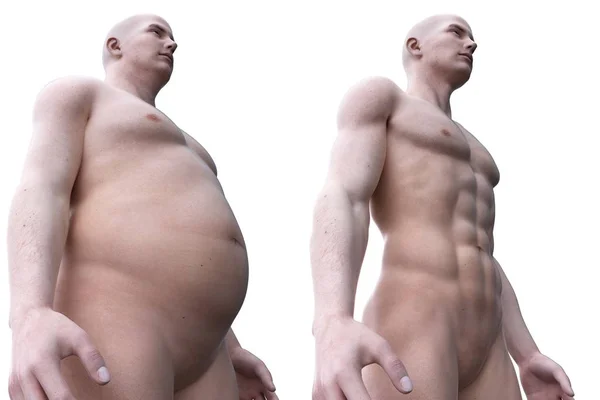 现实解剖模型中健康男性与肥胖男性的比较 数字图解 — 图库照片