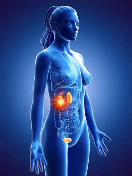 Silueta Mujer Con Cáncer Riñón Ilustración Digital Conceptual — Foto de Stock