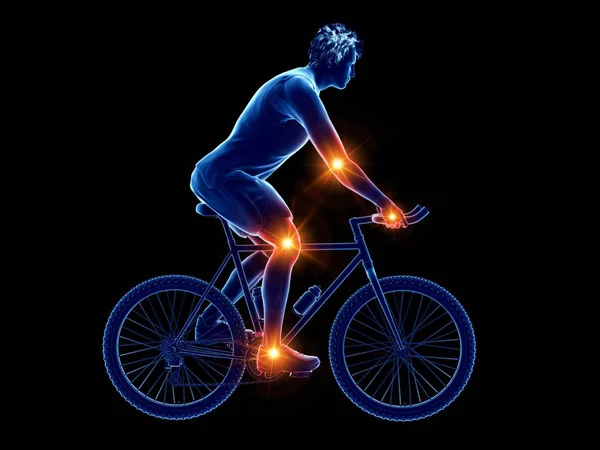 Cyclist Silhouette Places Joint Pain Conceptual Computer Illustration — Stock Photo, Image