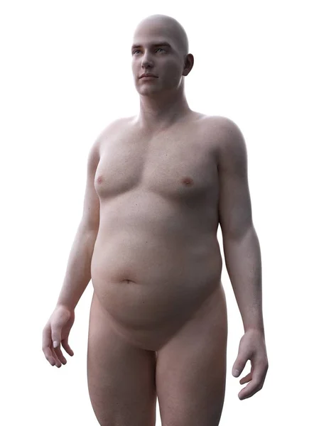 肥満男性の現実的な解剖学的モデル デジタルイラスト — ストック写真