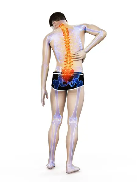 Vista Trasera Del Cuerpo Masculino Con Inflamación Dolor Espalda Ilustración —  Fotos de Stock