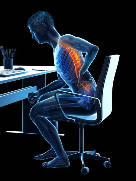 背中の痛みを伴うデスクオフィスワーカーシルエットに座る 概念的なイラスト — ストック写真