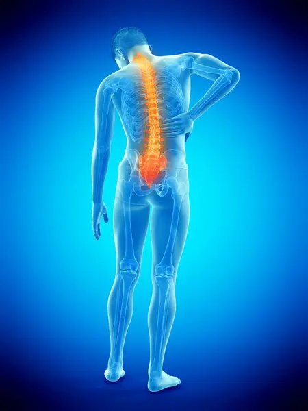 Rear View Male Body Inflammation Back Pain Conceptual Illustration — Stock Photo, Image