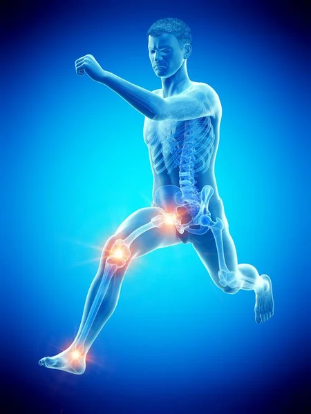 Running Man Points Joint Pain Conceptual Illustration — Stock Photo, Image