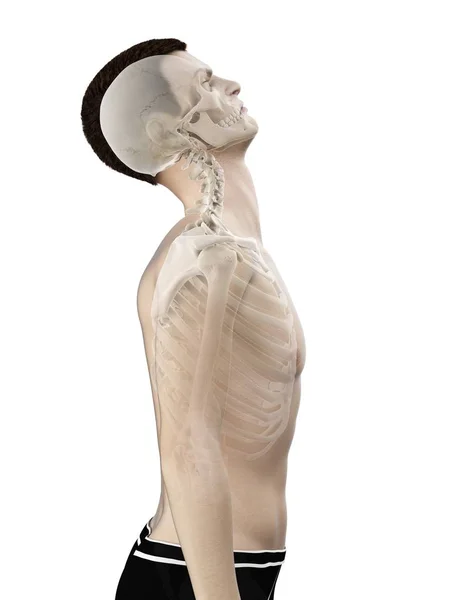 显示颈部损伤解剖学特征的男性侧影 数字图像 — 图库照片