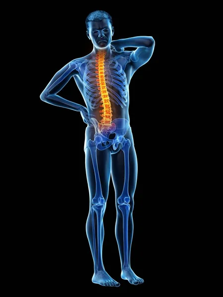 Male Body Back Pain Black Background Conceptual Illustration — Stock Photo, Image