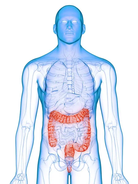 Manlig Kropp Med Sjuka Tjocktarmen Dator Illustration — Stockfoto