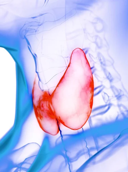 Sjukdomar Sköldkörteln Konceptuell Datorillustration — Stockfoto