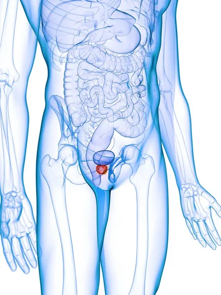 Prostata Infiammata Nel Corpo Maschile Astratto Illustrazione Digitale — Foto Stock