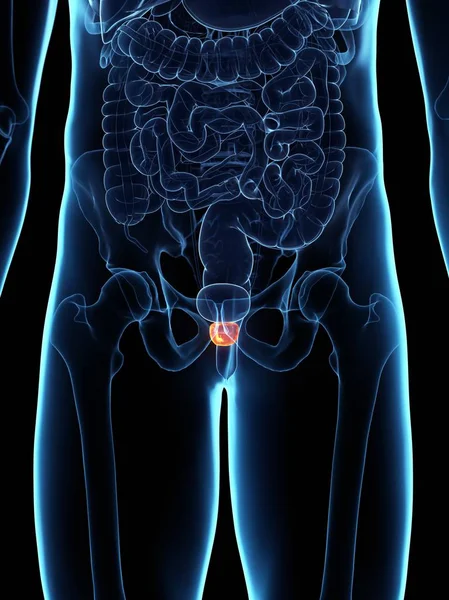 추상적 신체에서 전립선에 염증이 디지털 일러스트 — 스톡 사진