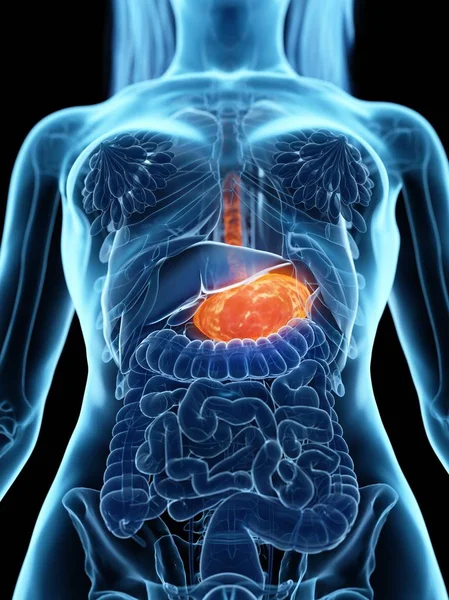Estómago Enfermo Cuerpo Femenino Abstracto Ilustración Digital —  Fotos de Stock