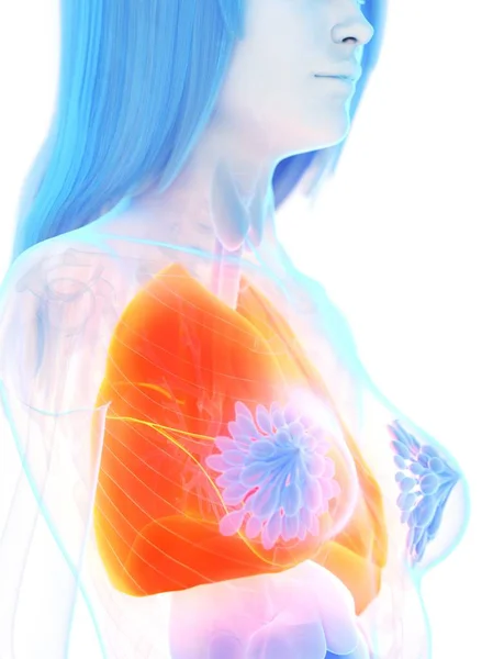 オレンジ色の肺で女性の体のシルエット コンピュータイラスト — ストック写真