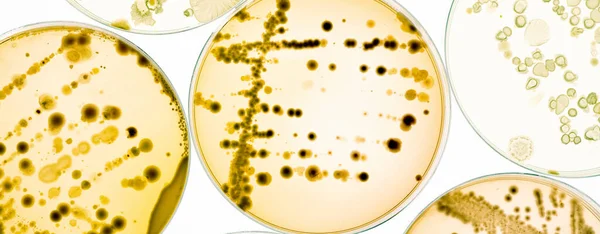 Bacterial Colonies Agar Plates — Stock Photo, Image