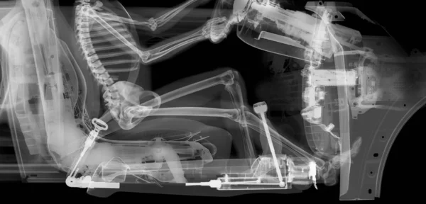 Crop Skeleton Driver Car Ray — Stock Photo, Image
