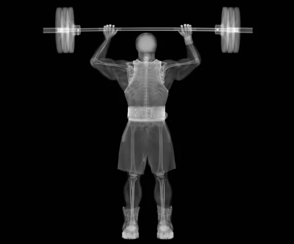 Gewichtheber Bodybuilder Skelett Röntgen — Stockfoto