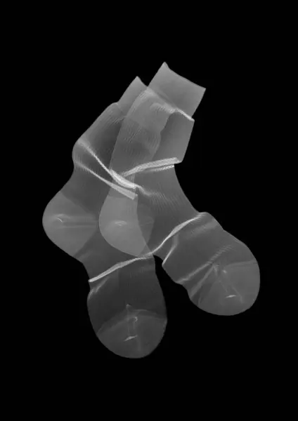 Strumppar Röntgenbilder — Stockfoto