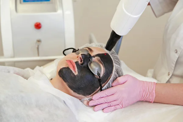 Verfahren Kohlenstoff Peeling Laserverjüngung Und Aufhellung Der Haut Behandlung Problematischer — Stockfoto