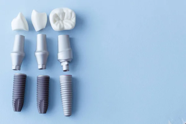 Model Shows Teeth Have Been Capped Stainless Pin Gums — Stock Photo, Image