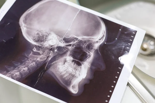 Röntgen Des Kopfes Der Arztpraxis — Stockfoto