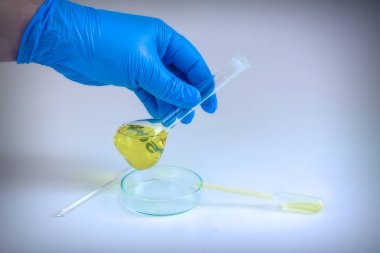 Bir el, diğer kimyasal cam arasında, sarı bir sıvı ile kimyasal bir şişe tutuyor