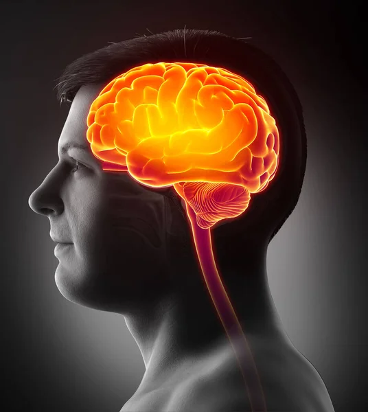 Renderizado Ilustração Medicamente Precisa Cérebro Dor Cabeça Realçado Masculino — Fotografia de Stock
