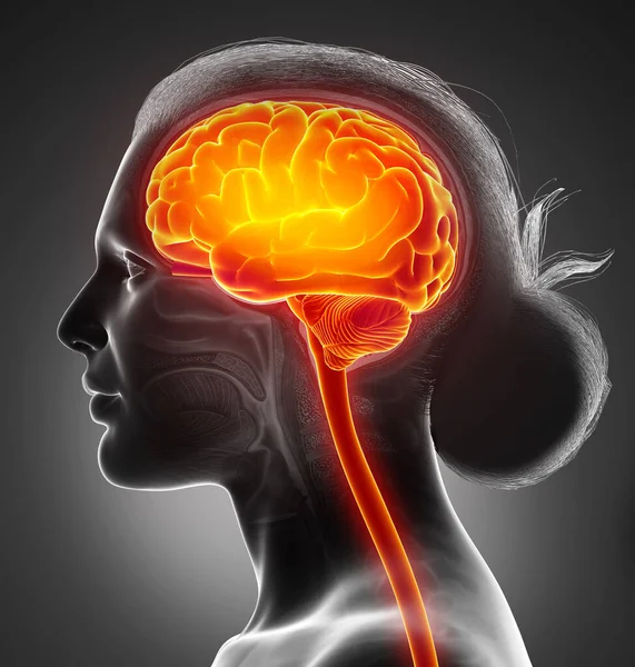 Gerenderte Medizinisch Korrekte Illustration Eines Weiblichen Markierten Gehirns Kopfschmerzes — Stockfoto