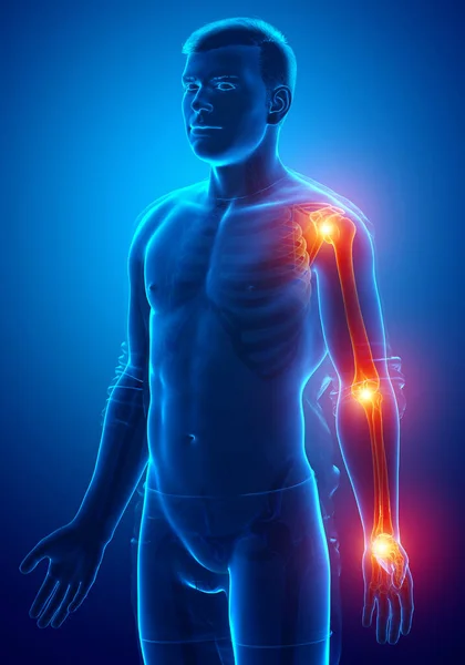 Illustration Men Arm Joint Pain — Stock Photo, Image