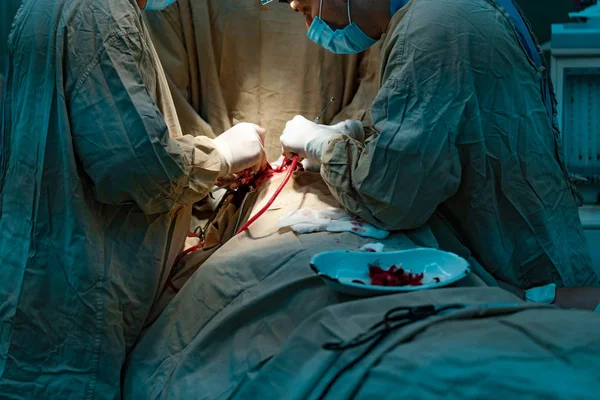 Sebészek Állni Ember Arcára Valamilyen Műveletet Végrehajtani Egy Kórházban Lemez — Stock Fotó