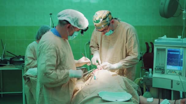 Chirurgii Zespół Chirurgów Wykonywanie Operacji Szpitalu Blok Operacyjny — Wideo stockowe
