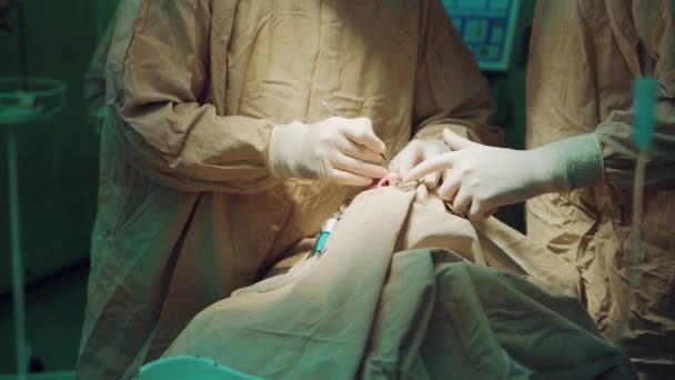 Χειρουργοί Είναι Απασχολημένος Στο Δωμάτιο Έκτακτης Ανάγκης Εκτέλεση Χειρουργικής Επέμβασης — Αρχείο Βίντεο