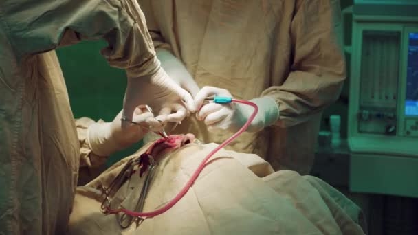 Dos Cirujanos Operan Quirófano Trabajar Con Instrumentos Quirúrgicos — Vídeo de stock