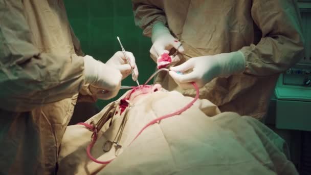 Два Хирурга Делают Операцию Операционной Работа Хирургическими Инструментами — стоковое видео