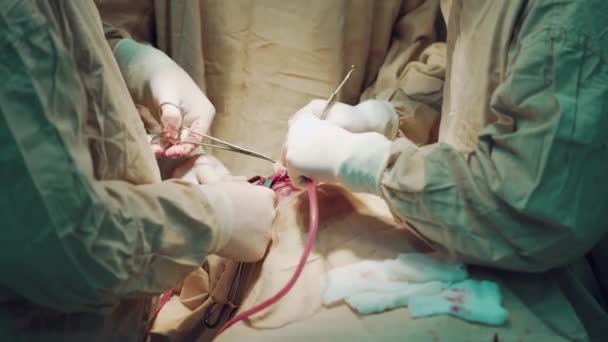 医疗队在医院手术室进行操作 使用手术器械 — 图库视频影像