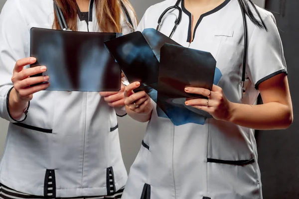 Deux Femmes Orthopédistes Médecins Tiennent Dans Leurs Mains Quelques Rayons — Photo