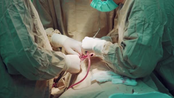 Χειρουργός Στη Μάσκα Εστιάζει Λειτουργία Στο Νοσοκομείο Της Την Περιστοιχισμένη — Αρχείο Βίντεο