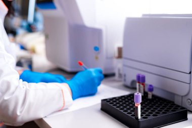 Kadın ellerinin otomatik makineden çıkan kanla tüpü doldurduğu yakın plan. Teknisyen, kapalı alandaki tüpler üzerinde çalışırken laboratuvar ekipmanı kullanıyor..