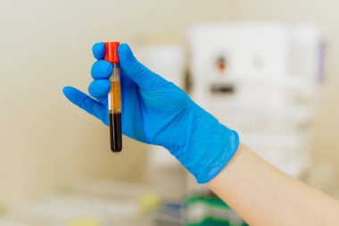 Tıbbi malzeme. Kan testi