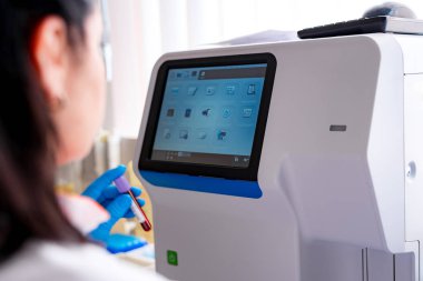 Kan testi için modern bir makinede çalışan bir kadın.