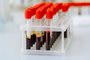 Birçok test tüpü kan test ediliyor. Tıbbi donatım.