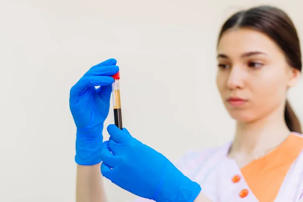 Técnico médico segurando tubo de sangue em laboratório. Equ médico — Fotografia de Stock
