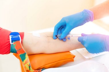 Hemşire hastanedeki bir hastanın koluna iğne şırıngası batırıyor. Mavi steril eldivenli kadının elleri bir araştırma laboratuvarında kan testi için kan örneği alıyor. Close.