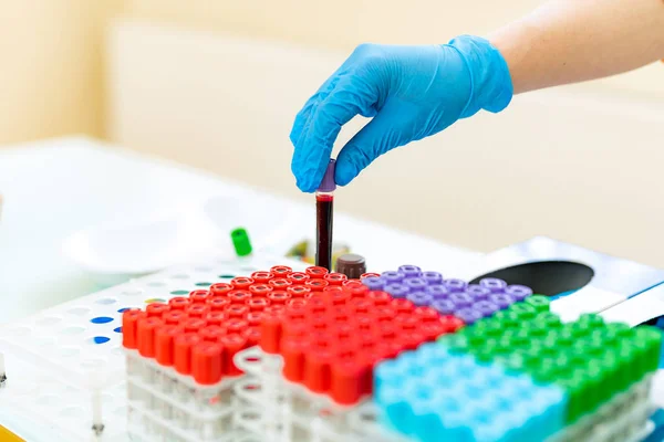 Enfermeira feminina coloca amostras de sangue em tubos em um rack especial em uma mesa. As mãos do médico em luvas de látex azul colocam o tubo de teste em um rack com muitos frascos coloridos em um laboratório. Close-up . — Fotografia de Stock