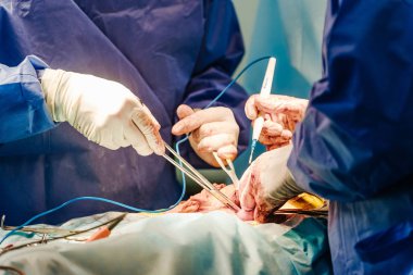 Operasyon sırasında kullanılan cerrahi ekipmanlar. Modern Ameliyathane