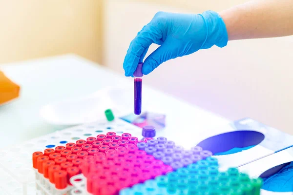 Amostra de sangue. Técnico de laboratório segurando amostra de tubo sanguíneo para estudo — Fotografia de Stock