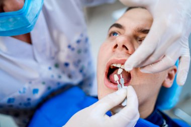 Genç yakışıklı esmer adam diş tedavisi görüyor. Diş hekimi beyaz tıbbi eldiven takıyor. Diş beyazlatma.