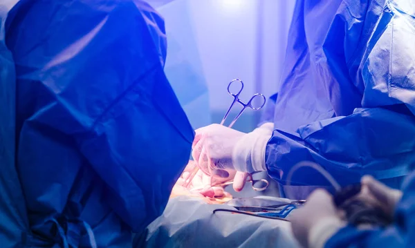 외과의 팀 이 수술실에서 일하고 있습니다. 의사 손을 봉합하는 거야. 의료 장비를 사용하는 수술 과정. — 스톡 사진