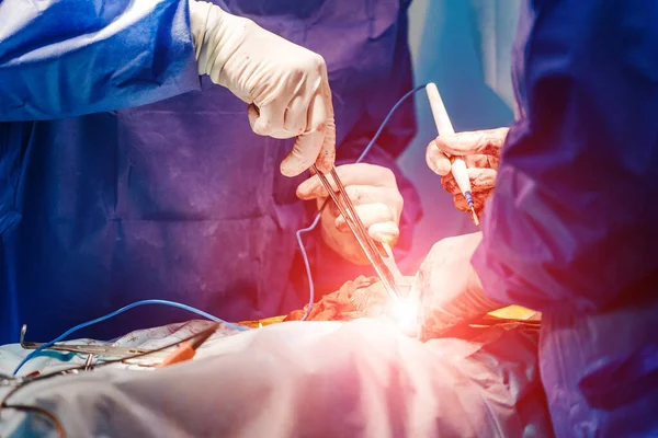 Team surgeon at work in operating room. Closeup of doctors' hands. Process of surgery operation using medical equipment. — Stock Photo, Image
